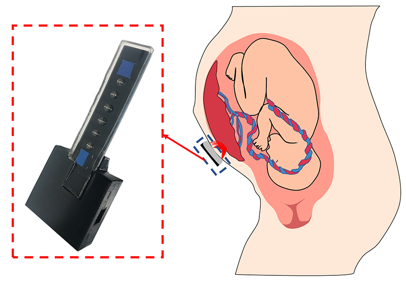 The oxygen sensor next to a diagram of a fetus and placenta in the uterus.