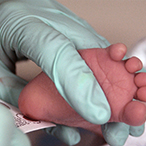 Blood sample being taken from a newborn’s heel for screening.