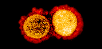 Colorized transmission electron micrograph of SARS-CoV-2 particles isolated from a patient.