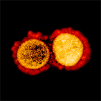 Colorized transmission electron micrograph of SARS-CoV-2 particles isolated from a patient.