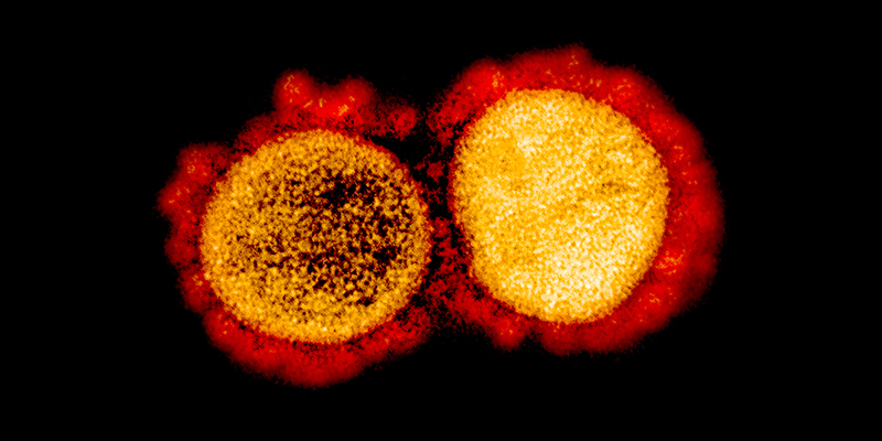 Colorized transmission electron micrograph of SARS-CoV-2 particles isolated from a patient.