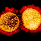 SARS-CoV-2 viruses