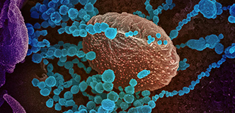 Microscopy image of SARS-CoV-2.