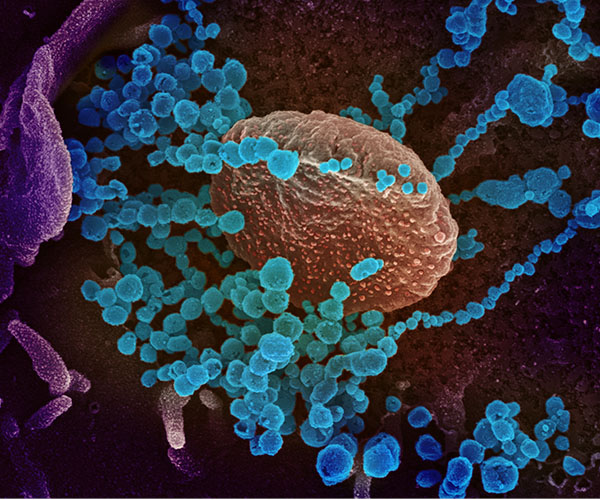 Microscopy image of SARS-CoV-2.