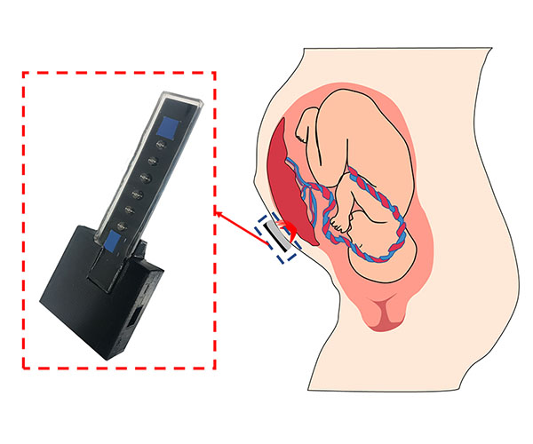 The prototype oxygen sensor next to a diagram of a fetus with forward-facing placenta. 