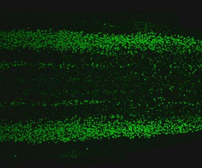Green dots are visible against a black background. The spectrum of dots is mostly symmetrical, and the spinal column runs from left to right.