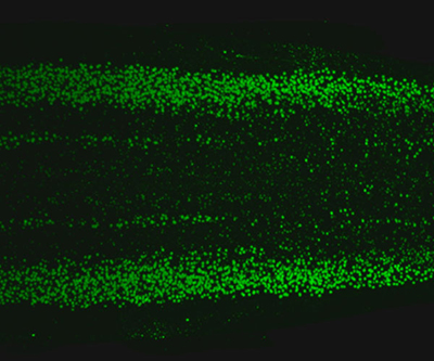 Green dots are visible against a black background. The spectrum of dots is mostly symmetrical, and the spinal column runs from left to right. 