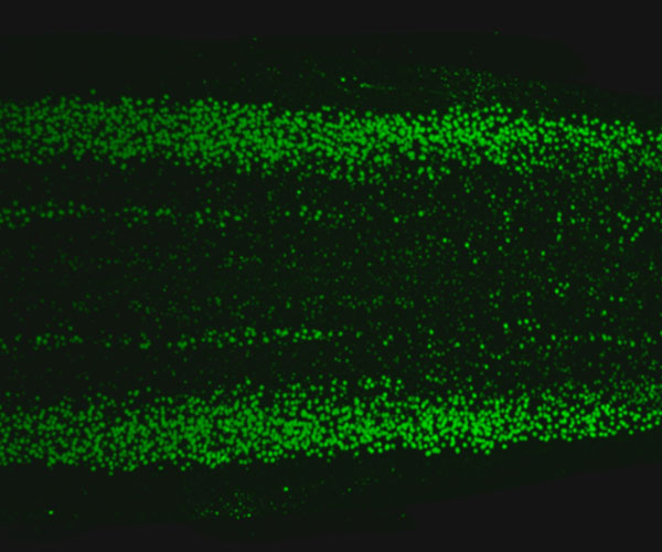 Green dots are visible against a black background. The spectrum of dots is mostly symmetrical, and the spinal column runs from left to right. 