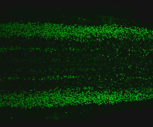Green dots are visible against a black background. The spectrum of dots is mostly symmetrical, and the spinal column runs from left to right.