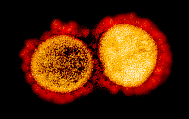 Colorized transmission electron micrograph of SARS-CoV-2 particles isolated from a patient.