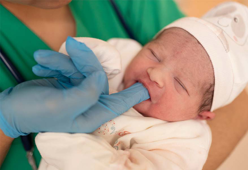 Gloved hand inserting finger inside infant’s mouth.