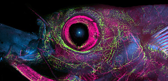 The image is zoomed in on the zebrafish head, with the eye (pink) and various vessel (green) visible against a black background.
