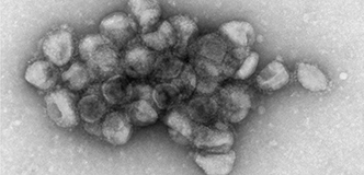 Electron microscopy image of an aggregate of pseudotyped viral particles bearing the SARS-CoV-2 Delta variant spike protein.