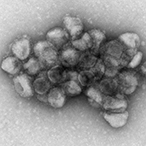 Electron microscopy image of an aggregate of pseudotyped viral particles bearing the SARS-CoV-2 Delta variant spike protein.