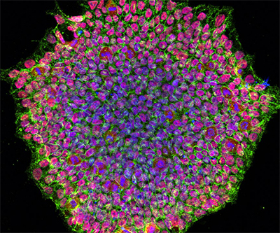 A collection of cells colored green, red, and blue forms a large circle.