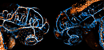 The microscopy image shows fluorescent colors against a black background.