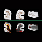 The upper panel, labeled “histology,” shows three brain sections with brown areas indicating astrogliosis. Below a green line, the lower panel, labeled “multidimensional MRI,” shows the same three brain sections with yellow-to-red areas indicating astrogliosis. A scale bar appears on the right.