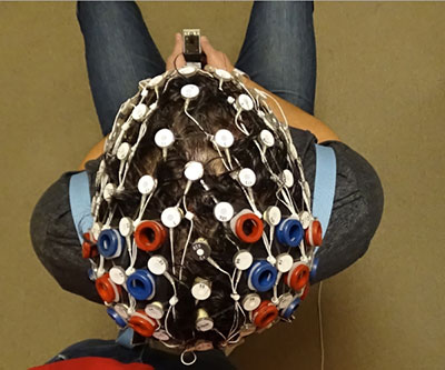 Bird’s-eye view of the top of a person’s head. The cap, which covers the entire head, has nodes that are colored white, red, or blue. 