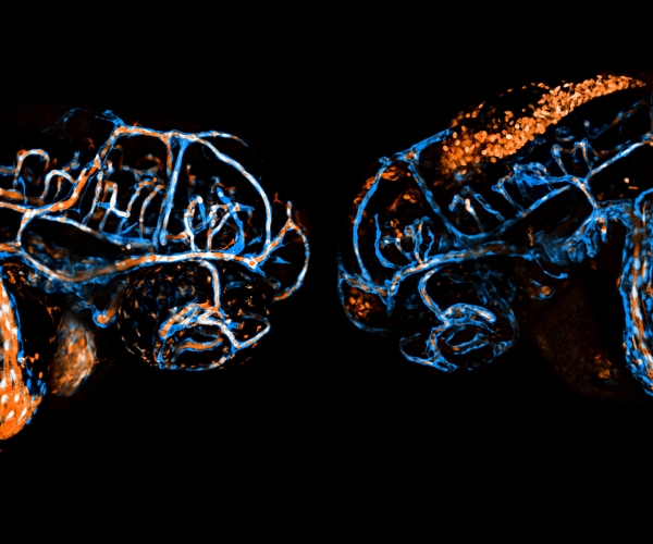 The microscopy image shows fluorescent colors against a black background. The mutant embryo’s head has a large cluster of orange blood cells.