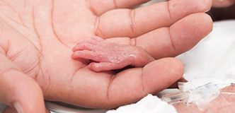 Adult hand holding a tiny preterm infant’s hand.