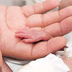 Adult hand holding a tiny preterm infant’s hand.