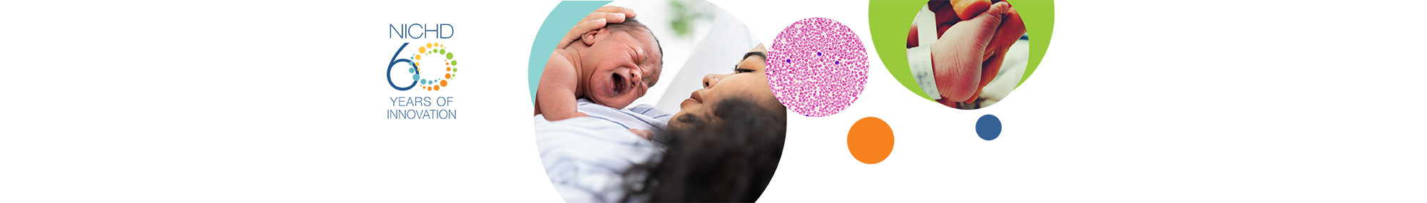 A series of three images related to infant screenings including: a mother with a crying child on her chest (left), a microscopic image of red blood cells in a blood smear (middle), and a baby’s foot with a medical bracelet around the ankle (right) all alongside the NICHD 60 years logo.