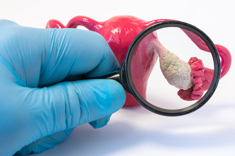 Gloved hand holding a magnifying glass to examine a plastic model of an ovary.