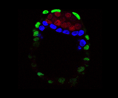 Illustration of the HIV replication cycle within one host cell. HIV fuses with the host cell, and the viral genome and proteins enter. Eventually, viral DNA is created and integrates into the host DNA. Thus, the host’s normal transcription machinery begins making new copies of viral RNA and HIV proteins, which move to the surface of the cell, where mature infectious virus forms and buds off.