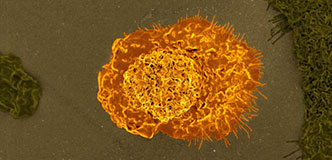 Colorized scanning electron micrograph of a macrophage.