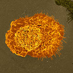 Colorized scanning electron micrograph of a macrophage.