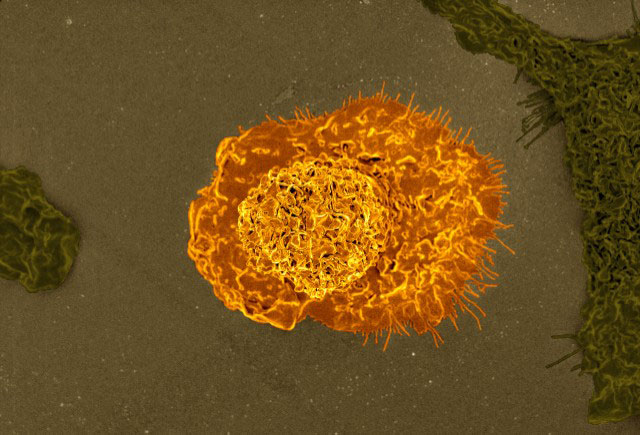 Colorized scanning electron micrograph of a macrophage.