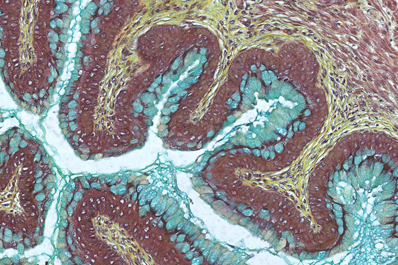 Microscopy image of a section of tissue. The center shows white and blue branching against a reddish brown background of cells.