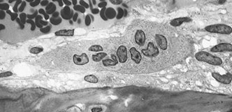Light micrograph of an osteoclast displaying multiple nuclei.