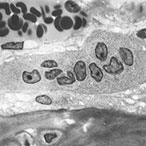 Light micrograph of an osteoclast displaying multiple nuclei.