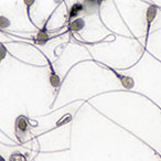 Sperm cells.