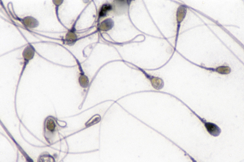 Sperm cells.