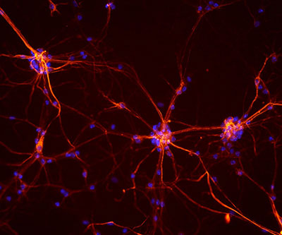 Red- and blue-colored cells branch out against a black background