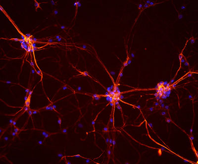 Red- and blue-colored cells branch out against a black background.