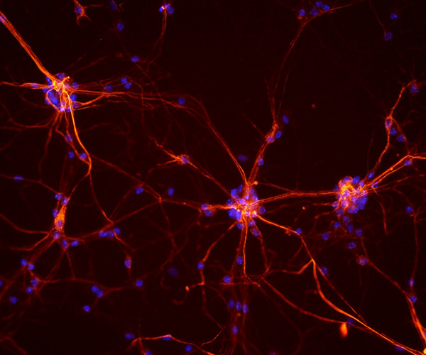 Red- and blue-colored cells branch out against a black background.