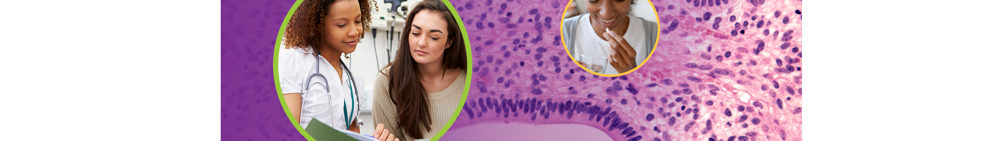 A series of three images relating endometriosis, including a woman talking to a healthcare provider (left), a woman taking medication (top right), and a microscope image of endometrial tissue (background). 