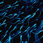 Graphic of sperm cells.