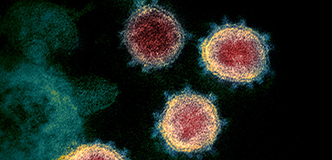 Electron micrograph of SARS-CoV-2.