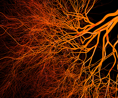 A fibrous mass of orange-red hair-like vessels against a black background branch from the top right corner to the bottom left corner.