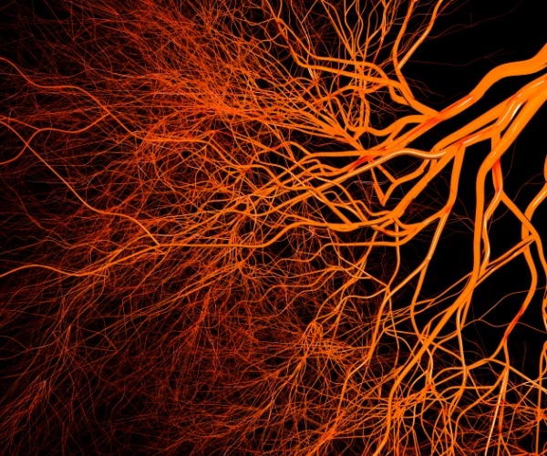 A fibrous mass of orange-red hair-like vessels against a black background branch from the top right corner to the bottom left corner. 