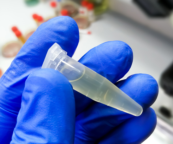 Gloved hand holding an Eppendorf tube containing cerebrospinal fluid.