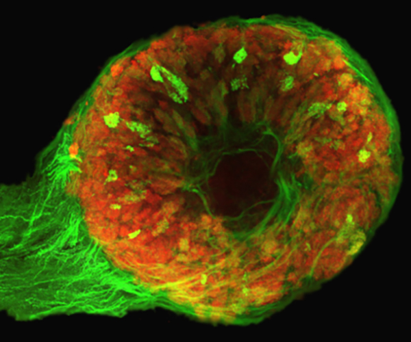 A donut-shaped mass of red cells is dotted with green against a black background. The green fibers are bunched along the lower left edge.