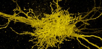 Microscopy image of yellow cells against a black background. The center junction contains many vessel-like projections. The axons of the two neurons are thicker and run from top left to bottom right.