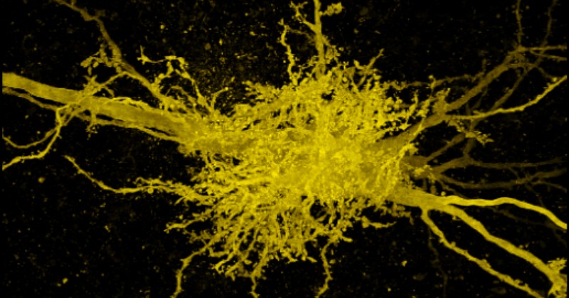 Microscopy image of yellow cells against a black background. The center junction contains many vessel-like projections. The axons of the two neurons are thicker and run from top left to bottom right.