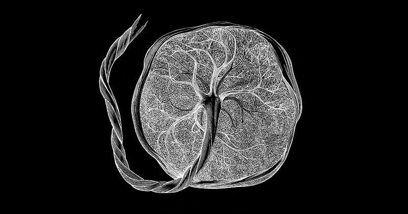 Graphic of the placenta.