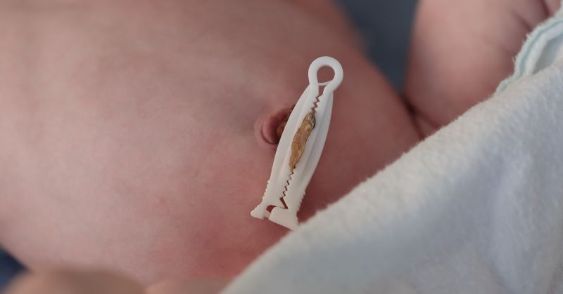 A newborn’s midsection showing the clamped remnant of the umbilical cord.
